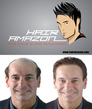 Hair Weaving / Hair Bonding / Non-Surgical Hair Replacement