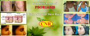 psoriasis treatment  chennai ,  cnrherbs,  drcnrajadurai,  cnr herbs revi