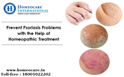 Get relief of psoriasis with Homeopathy Treatment