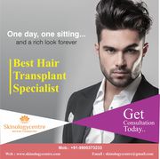  FUE Hair Transplant in Bangalore | FUE Hair Transplant Cost