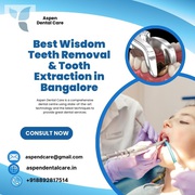 Best Wisdom Teeth Removal & Tooth Extraction in Bangalore